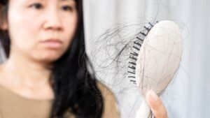 Common Causes of Hair Fall in Men and Women shown by hair strands collected on a hairbrush