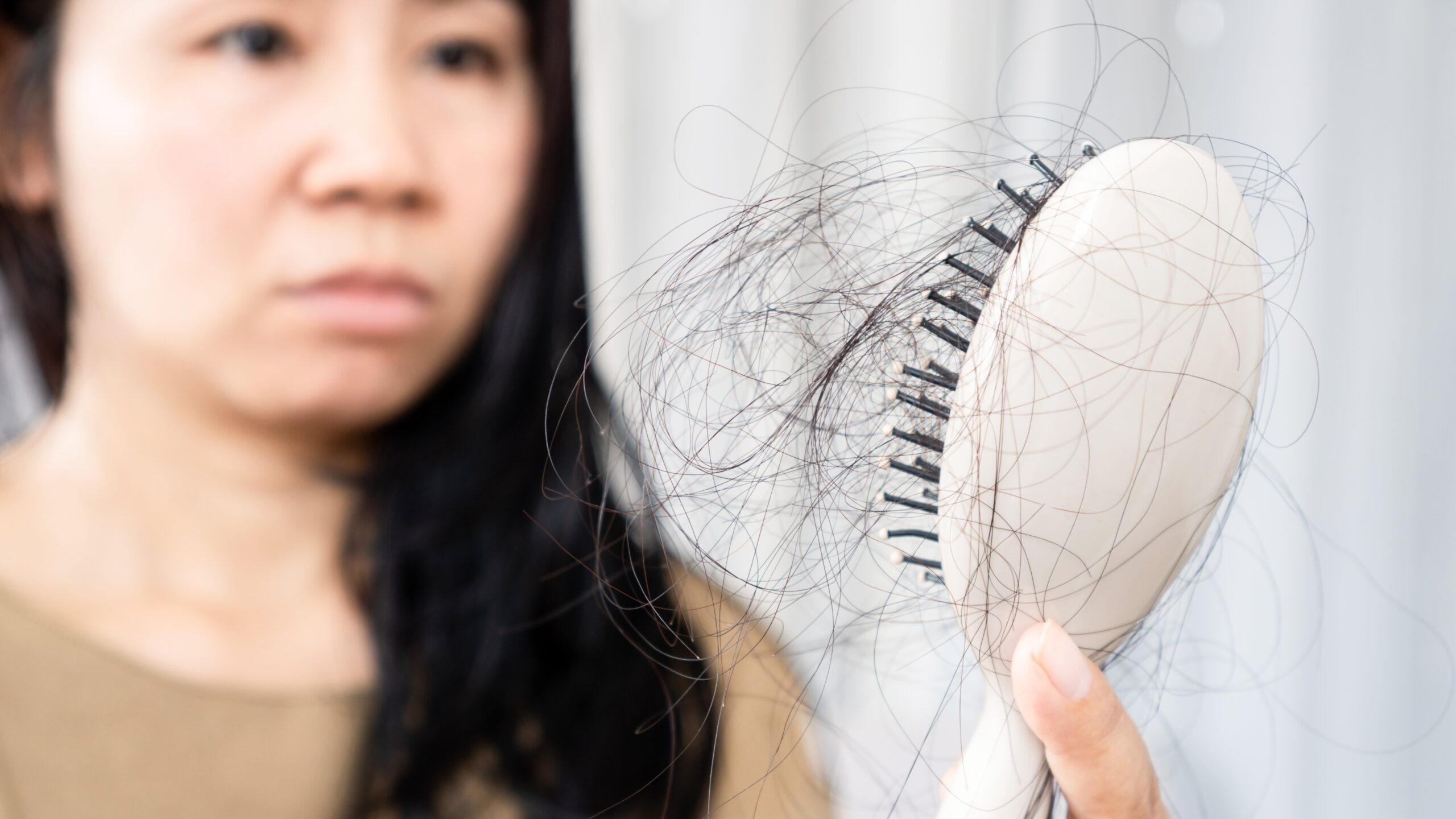 Common Causes of Hair Fall in Men and Women shown by hair strands collected on a hairbrush